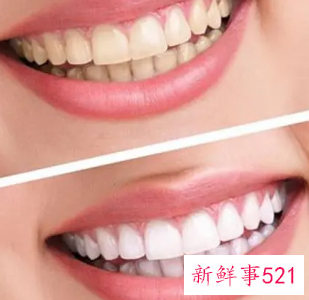 牙齿黄有哪些妙招来美白呢