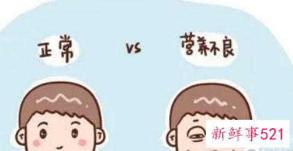 儿童营养不良的信号