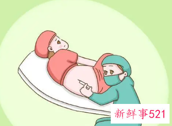 无痛分娩真的会导致腰酸吗