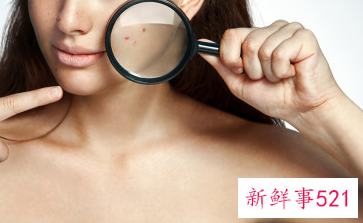 果酸对人体的危害