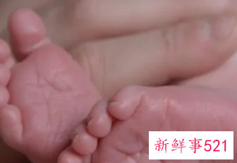 宝宝刚出生第一天怎么照顾