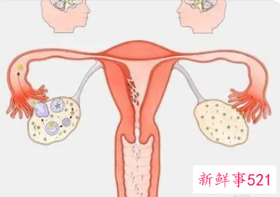 中年女性如何保养卵巢