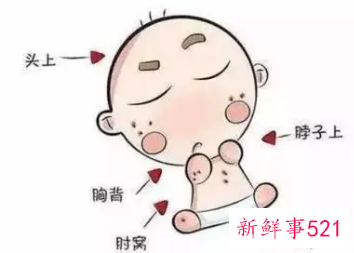 婴儿如何去痱子最有效