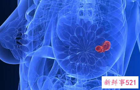 乳腺增生能揉开吗