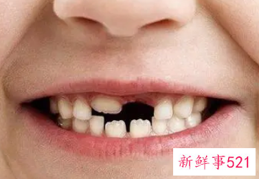 梦见掉门牙是什么意思