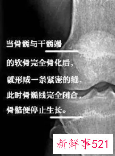 小孩测骨龄有什么影响