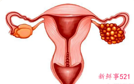 中年女性如何保养卵巢