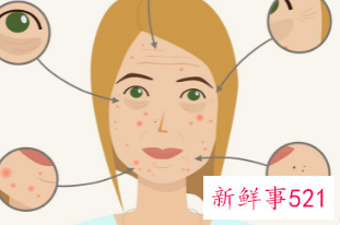 怎么减少黑色素