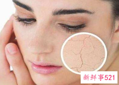 皮肤干燥起皱纹怎么办