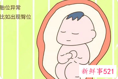 臀位破水的几率大不大