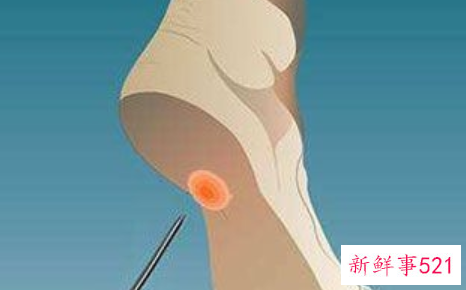 关于跑步有什么好处和坏处