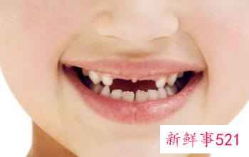 女人梦见掉牙有血