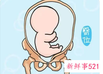 臀位破水的几率大不大