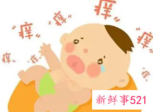 婴儿如何去痱子最有效