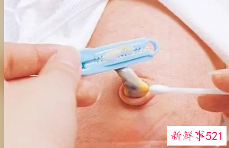 新生儿脐带擦拭的步骤