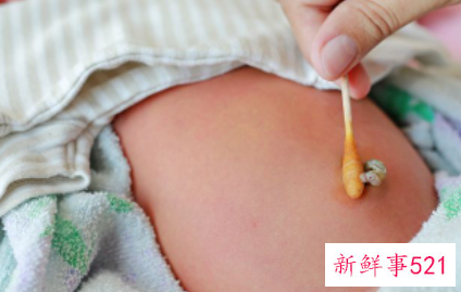 新生儿脐带擦拭的步骤