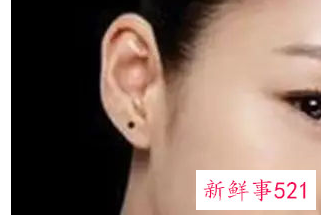 痣的位置与命运