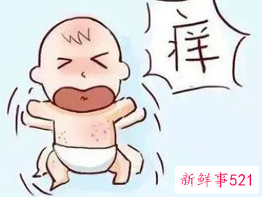 两个月的宝宝脸上出湿疹会下去吗