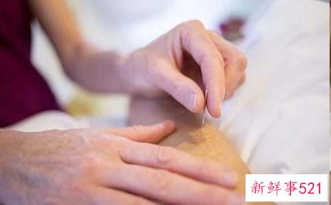 针灸推拿专业个人总结