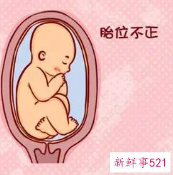 怀孕七个月胎位不正的原因
