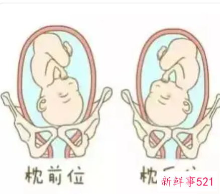 怀孕七个月胎位不正的原因