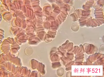 4大血型与性格大概分析