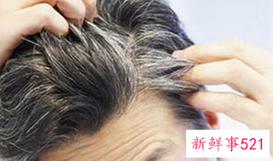 哪些食物吃了可以黑发