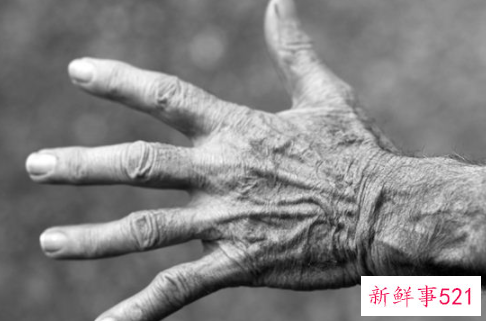 梦见自己额头长皱纹