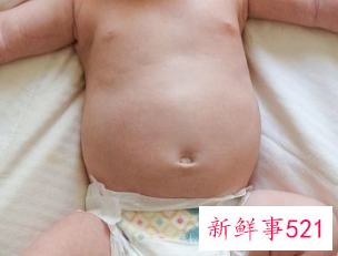 未满月婴儿肚子胀气怎么办吃什么药