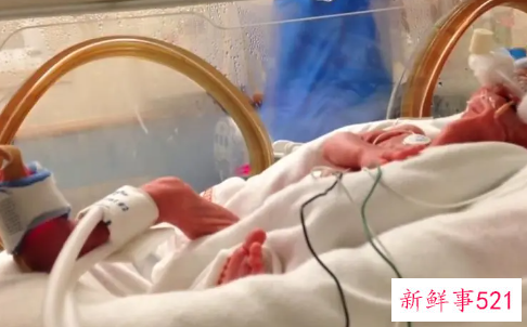 28周早产儿暖箱45天花费