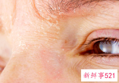 女人右上眼皮跳是什么预兆好不好