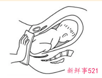 臀位宝宝危险吗