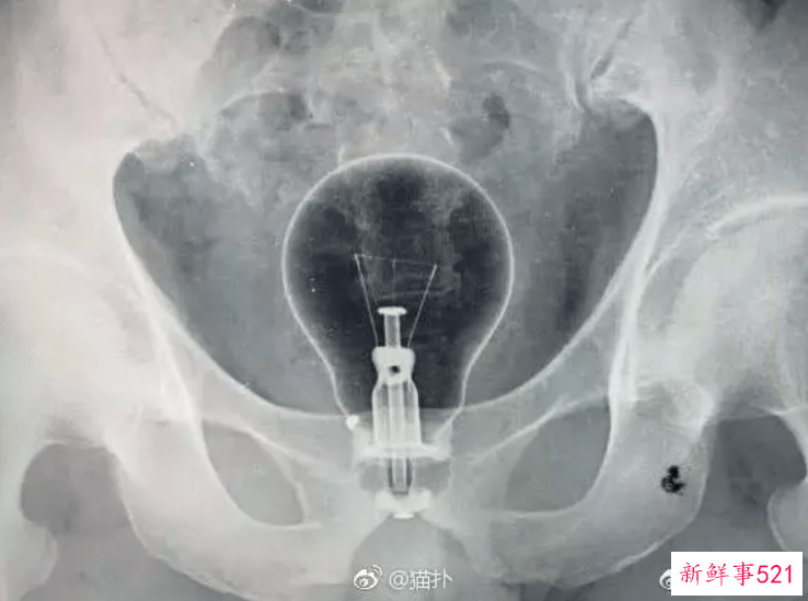 卧底仙女管销售群，背后的罪恶我不敢看…