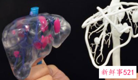 谷丙转氨酶偏高的原因是什么