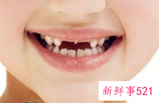 梦见掉下牙一定死人吗