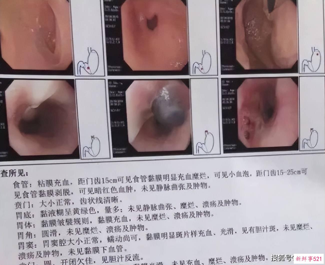 卧底仙女管销售群，背后的罪恶我不敢看…