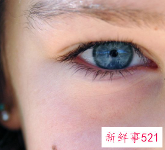 女人右上眼皮跳是什么预兆好不好