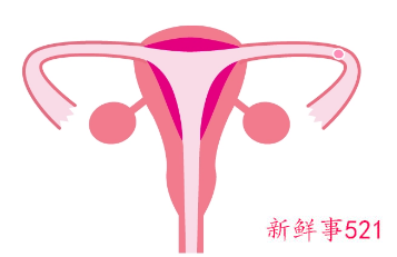 女孩月经颜色呈褐色什么原因