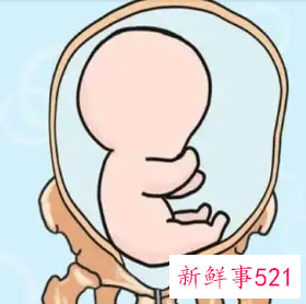 臀位的孕妇该怎么办