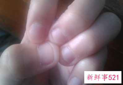 家长如何帮助孩子戒掉咬指甲的习惯