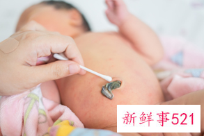 腰酸是不是要临产了