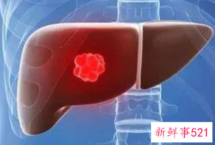 谷丙转氨酶偏高的原因是什么