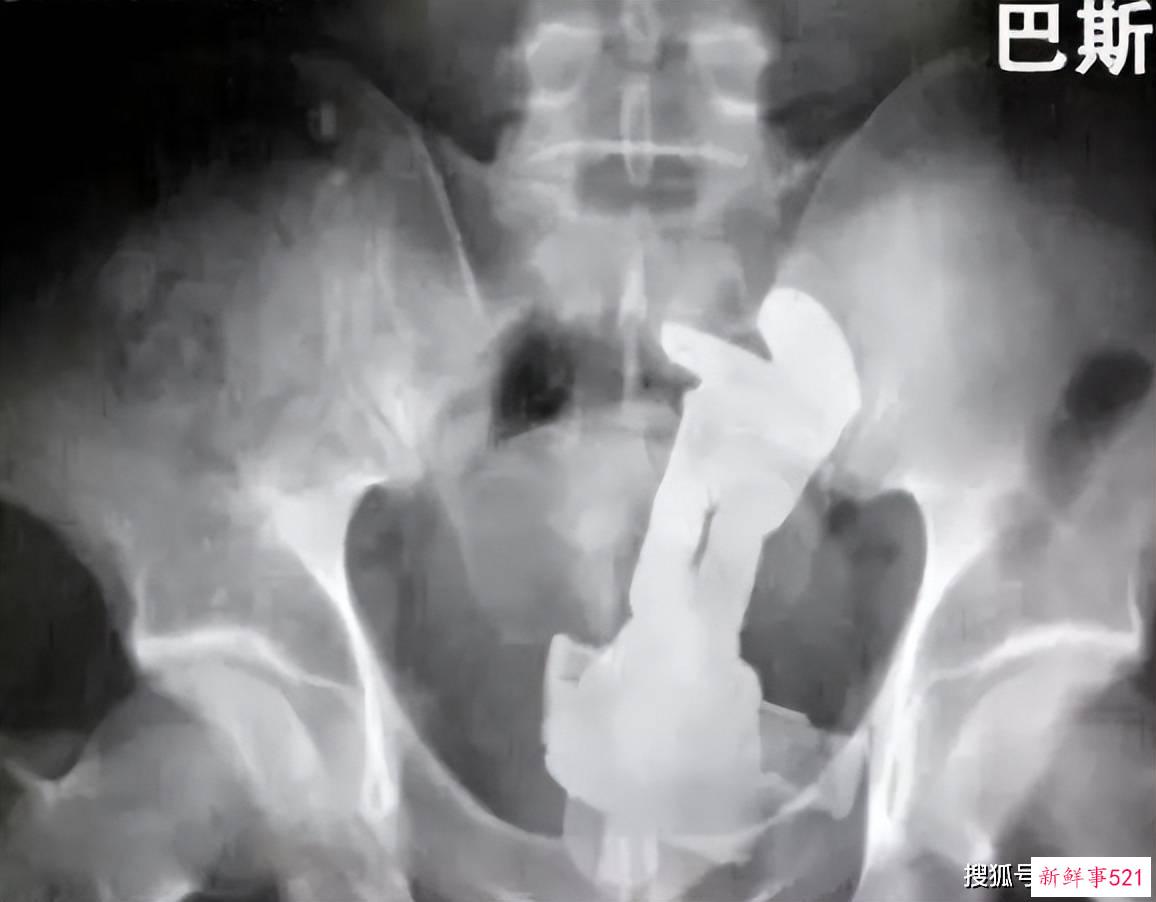 卧底仙女管销售群，背后的罪恶我不敢看…