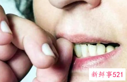 家长如何帮助孩子戒掉咬指甲的习惯