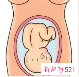 臀位宝宝危险吗