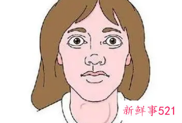 宝宝甲亢明显的症状