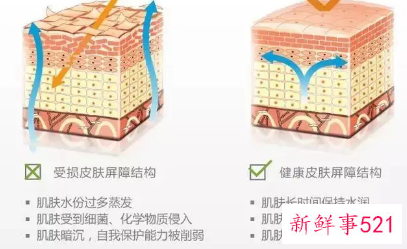 皮脂膜受损的原因有哪些