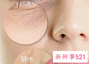 脸部缺水怎么办