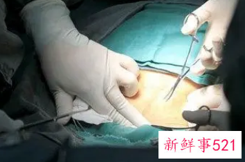 梦到去医院检查身体