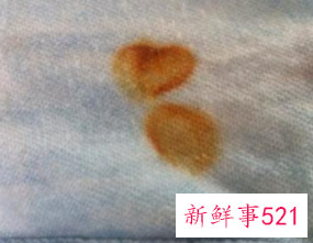 怎么洗干净衣服上的铁锈